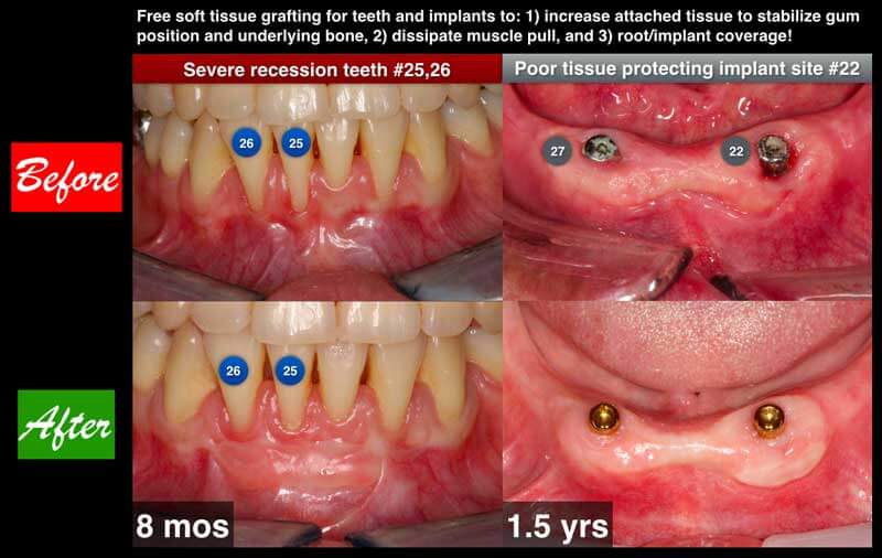 Clinical Treatment Example