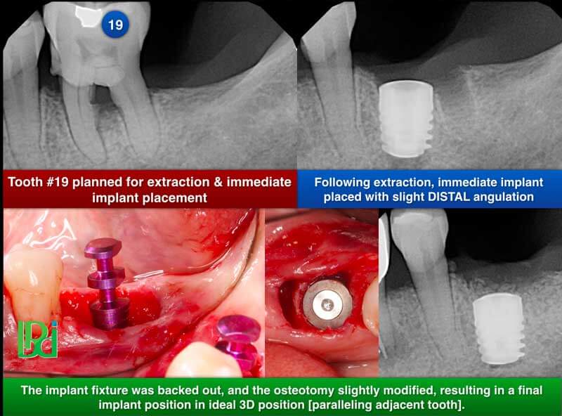 Clinical Treatment Example