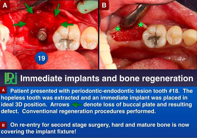 Clinical Treatment Example