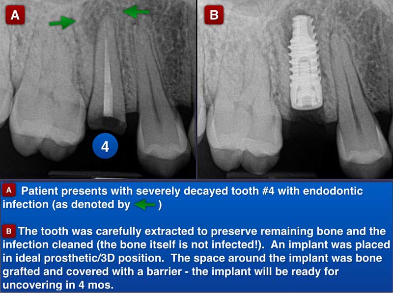 Clinical Treatment Example