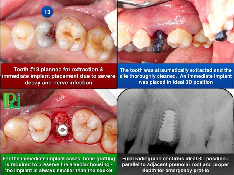 Clinical Treatment Example