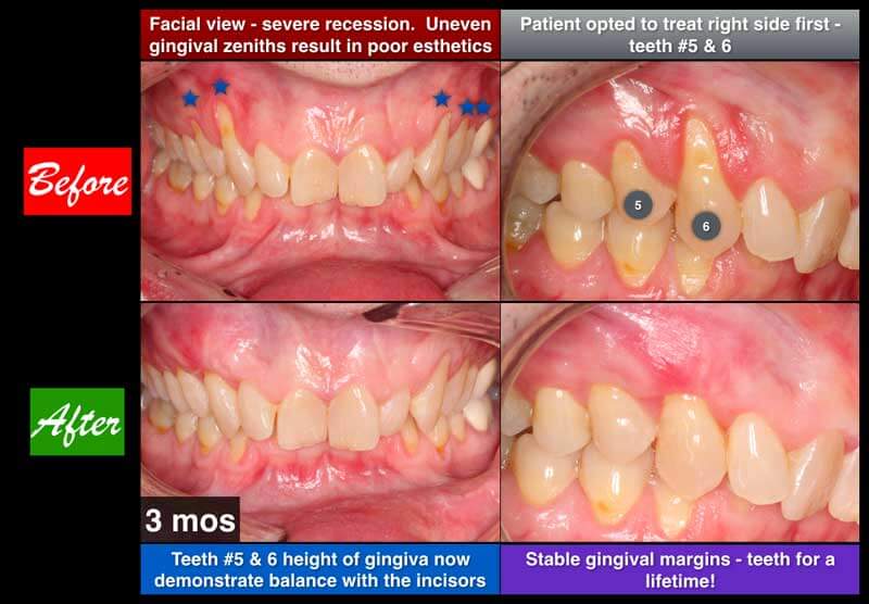 Clinical Treatment Example