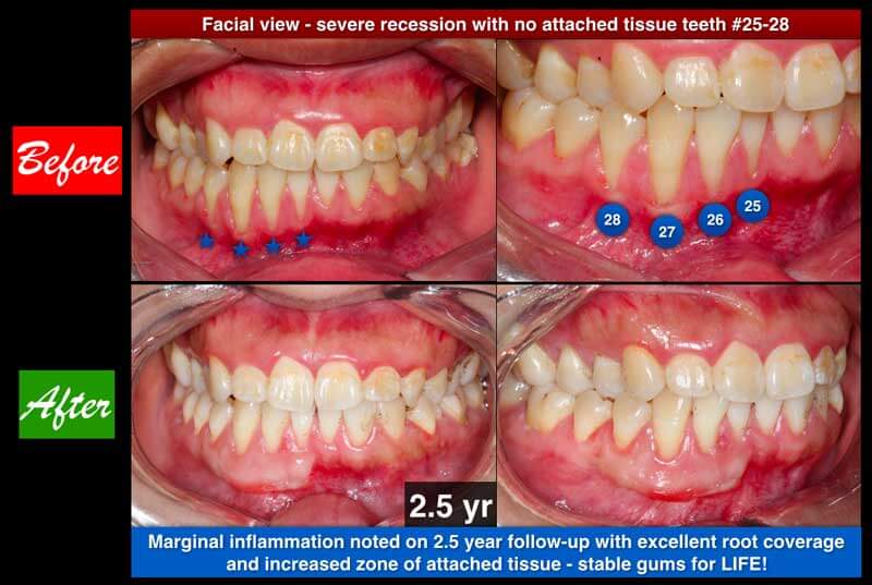 Clinical Treatment Example