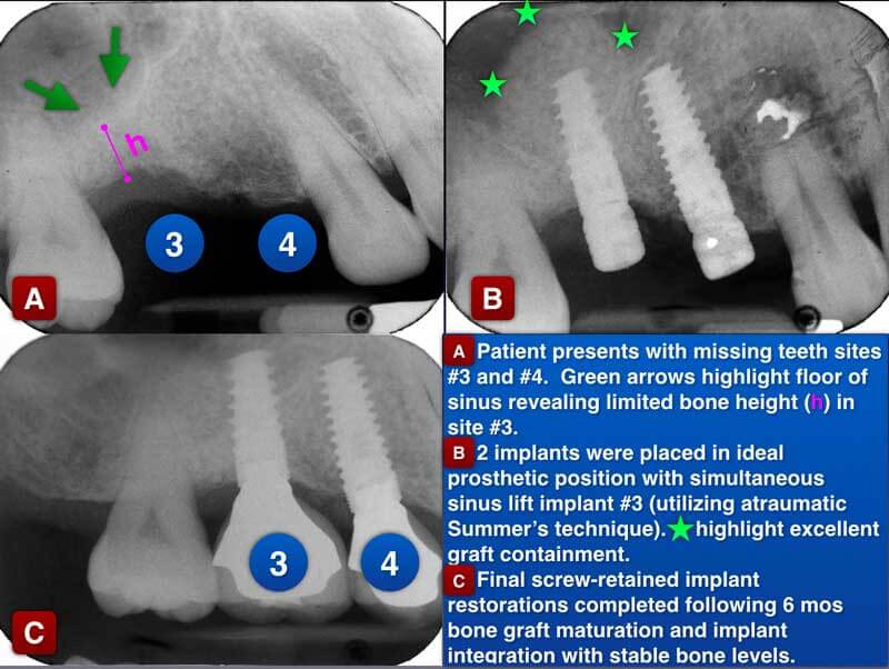 Clinical Treatment Example