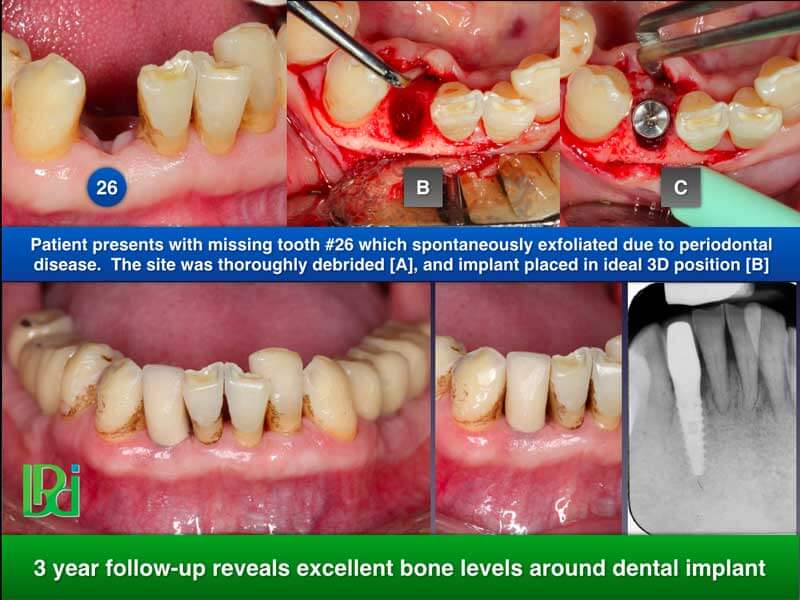 Clinical Treatment Example