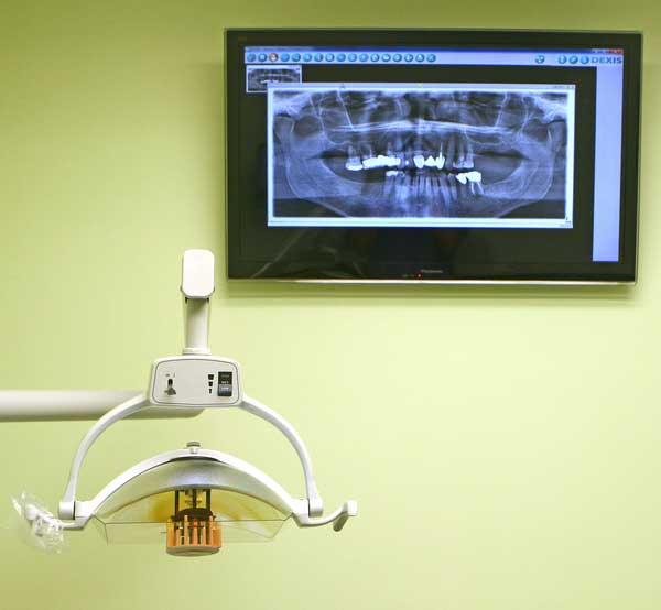 Cone Beam Scanner or Patient