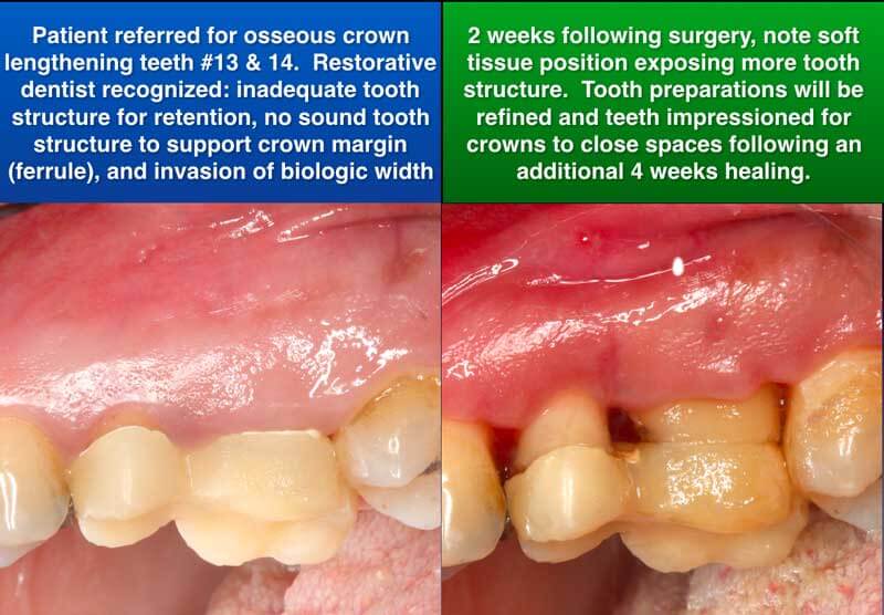 Clinical Treatment Example