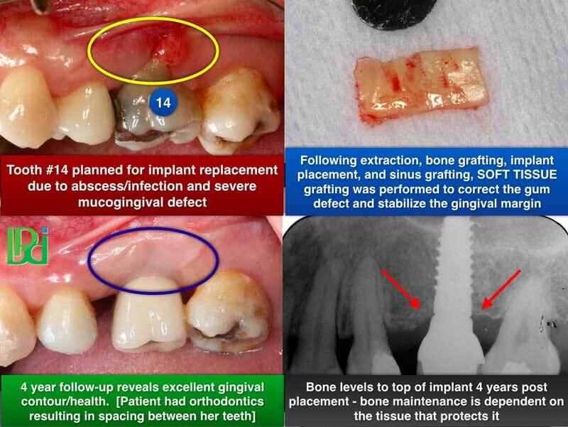 Clinical Treatment Example