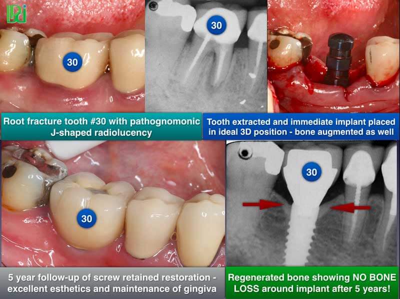 Clinical Treatment Example