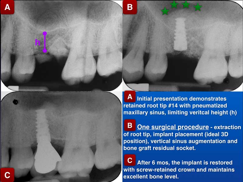 Clinical Treatment Example