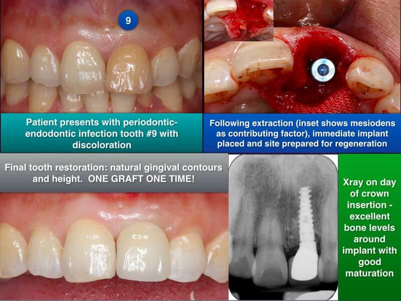 Clinical Treatment Example